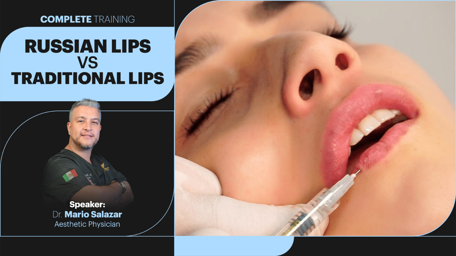 Russian Lips vs traditional lips (2)