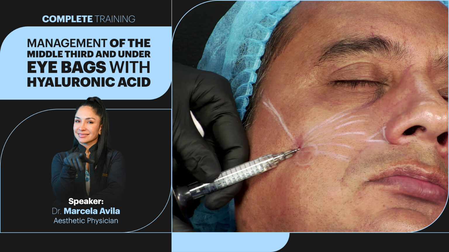 Manejo de tercio medio y ojeras-04